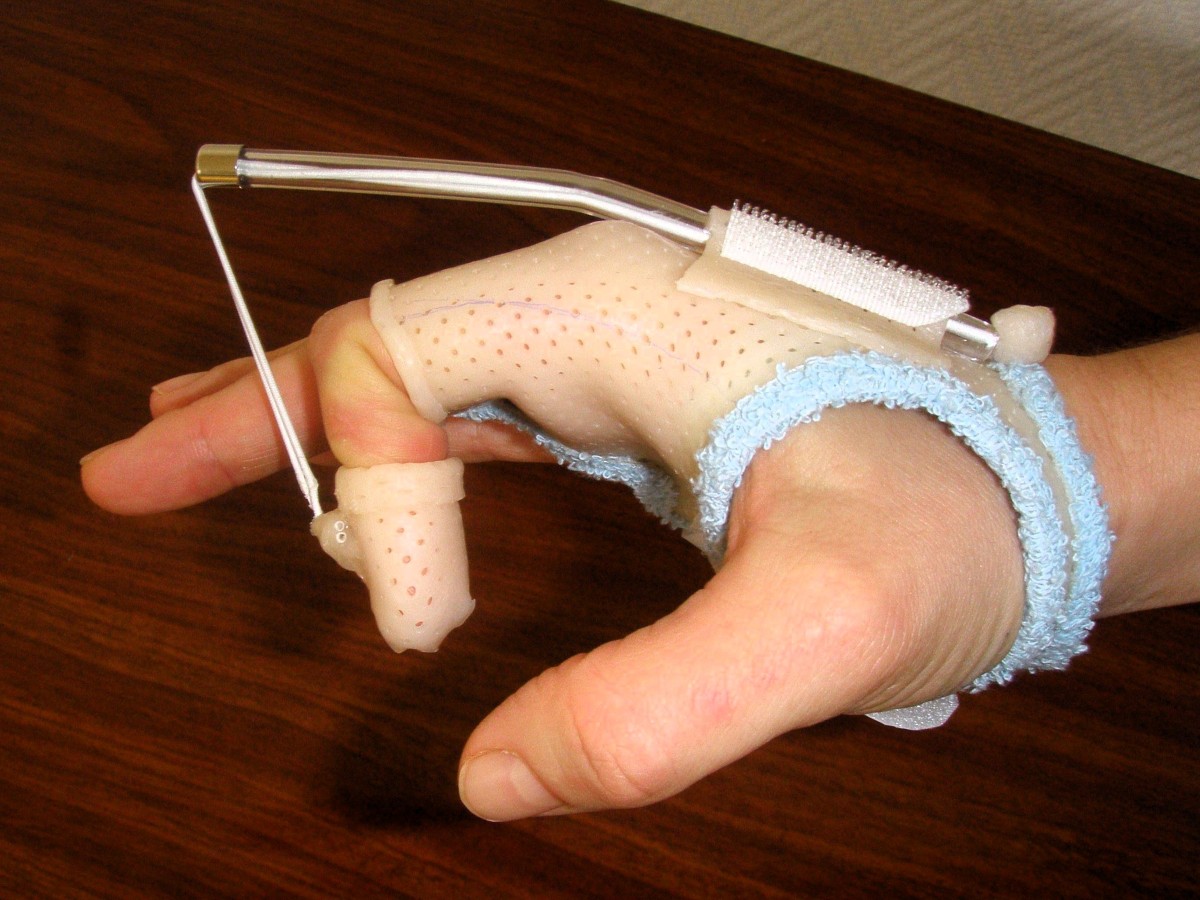 Travaux pratiques de formation en gypsothérapie